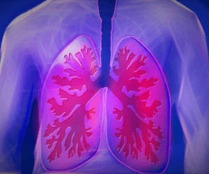 Read more about the article Tuberculosis Types and Symptoms